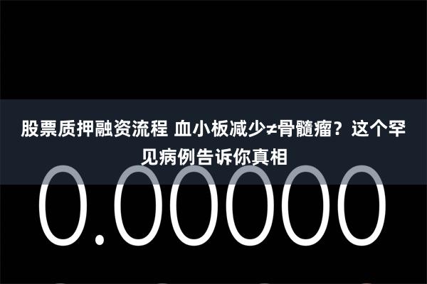 股票质押融资流程 血小板减少≠骨髓瘤？这个罕见病例告诉你真相